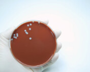 Staphylococcus-Aureus-manipulador